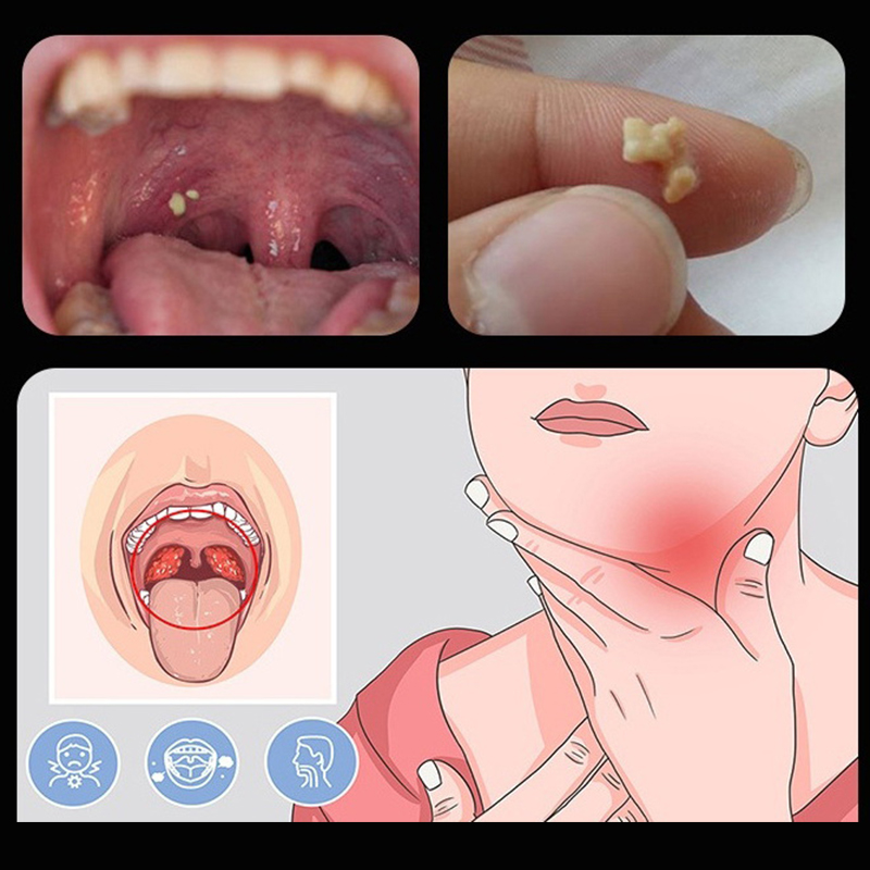 ~Ear Wax Tonsil Stone Remover  - огляд і ціна Ear Wax Remover